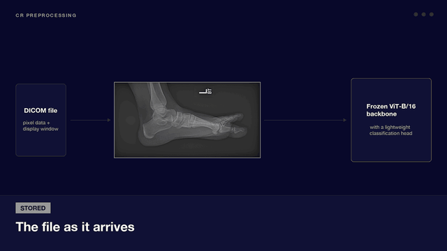 A foot radiograph passing through Epsilon's CR preprocessing pipeline